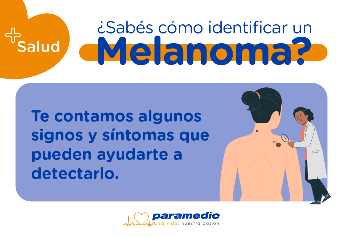 melanoma